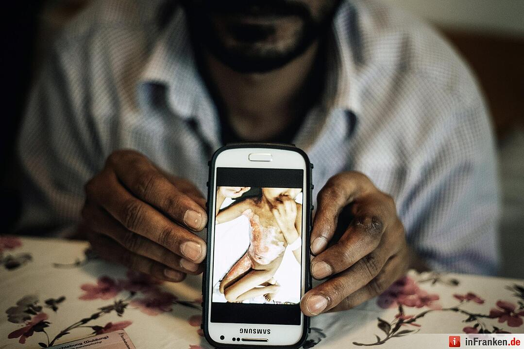 Mohamed aus Pakistan zeigt am 17.06.2015 in einer Flüchtlingsunterkunft in Hausham ein Handyfoto seiner Tochter, die bei einem Brandunfall schwer verletzt wurde. Das Motiv des freien Fotografen Florian Bachmeier aus Schliersee wurde zum "Pressefoto Bayern 2015" gekürt.