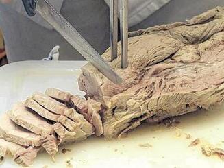 Schweinefleisch (Symbolbild)