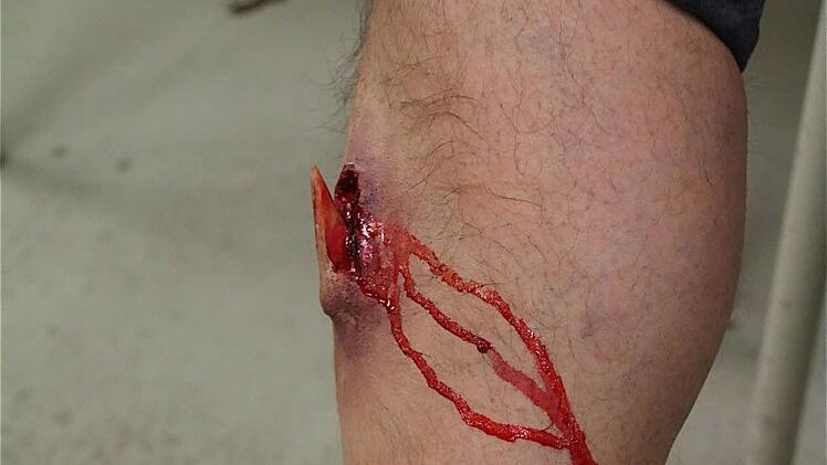 Perfekte Unfallschminke am Bein des Komparsen Franz Grosse.