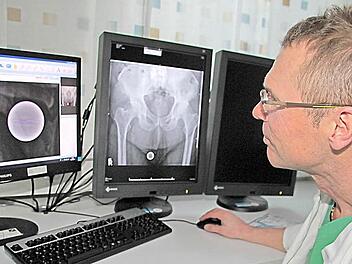 Wenn ein Patient Ersatz für ein kaputtes Gelenk braucht, muss das Implantat sorgfältig geplant werden. Hier bereitet Chefarzt Gerhard Finkenzeller die Operation eines neuen Hüftgelenks vor. Foto: Dagmar Besand