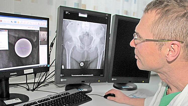 Wenn ein Patient Ersatz für ein kaputtes Gelenk braucht, muss das Implantat sorgfältig geplant werden. Hier bereitet Chefarzt Gerhard Finkenzeller die Operation eines neuen Hüftgelenks vor. Foto: Dagmar Besand