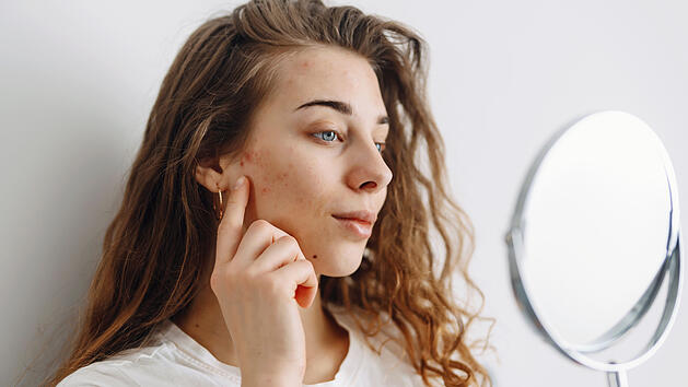 Bad, Haut, Spiegel, Gesicht, Pickel, Akne, Hautveränderung, Dermatologie, Hautproblem