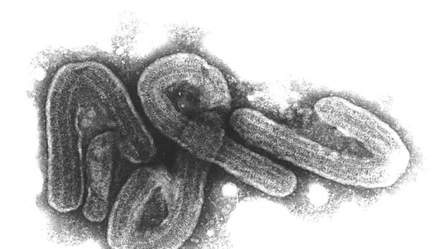 Sterblichkeit bis zu 88 Prozent: T&ouml;dliches Marburg-Virus - wie hoch ist die Gefahr f&uuml;r Deutschland?
