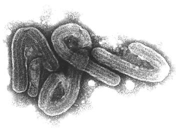 Sterblichkeit bis zu 88 Prozent: Tödliches Marburg-Virus - wie hoch ist die Gefahr für Deutschland?