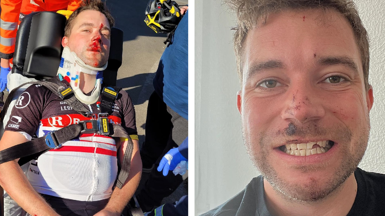 Dorfrocker: Philipp nach seinem Unfall in Franken