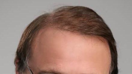 GeorgHötzelein