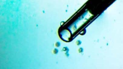 Danach werden sie mit einer Mini-Pipette eingesaugt. Foto: Uni-Klinikum Erlangen