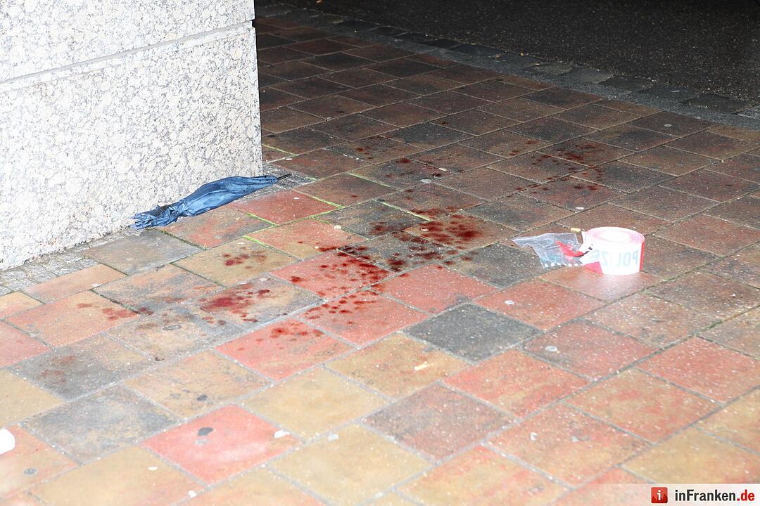 Versuchtes Tötungsdelikt in Ansbach – Opfer verletzt im Krankenhaus - Täter auf der Flucht