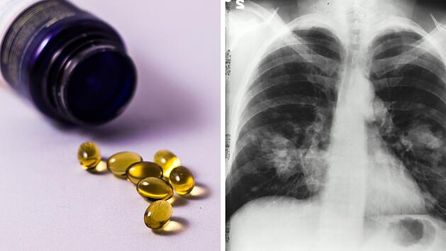 Vitamine und Krebs: Was du über Risiken wissen solltest