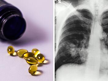 Vitamine und Krebs: Was du über Risiken wissen solltest