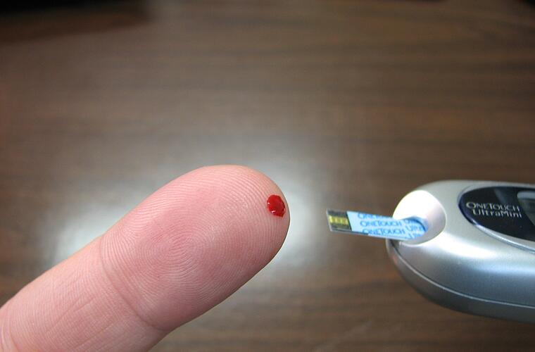 Nuovi studi su Corona: l’infezione da Covid-19 può portare al diabete