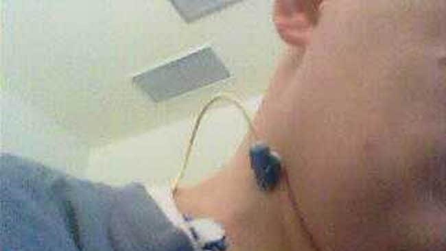 ... und er wird größtenteils künstlich ernährt.