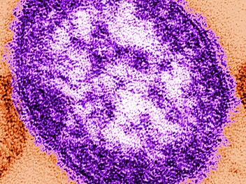 "Schwere Komplikationen" möglich: Masern breiten sich in Bayern rasant aus - Ministerin mit dringendem Appell "Schwere Komplikationen" möglich: Masern breiten sich in Bayern rasant aus - Ministerin mit dringendem Appell