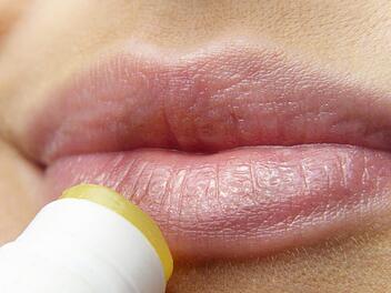 Angeblich sollen Lippenpflegestifte Herpes übertragen. Doch wie viel ist dran an diesem Gerücht? Hier erfahren Sie es! Symbolbild: pixabay/silviarita