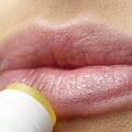 Angeblich sollen Lippenpflegestifte Herpes übertragen. Doch wie viel ist dran an diesem Gerücht? Hier erfahren Sie es! Symbolbild: pixabay/silviarita