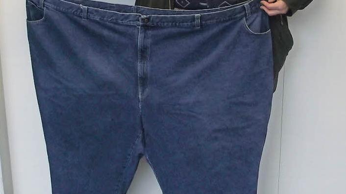 Ein im Klinikum Forchheim behandelter Patient zeigt die Hose, in die er einst passte, bevor es ihm gelang, 100 Kilogramm abzunehmen. Foto: Klinikum Forchheim