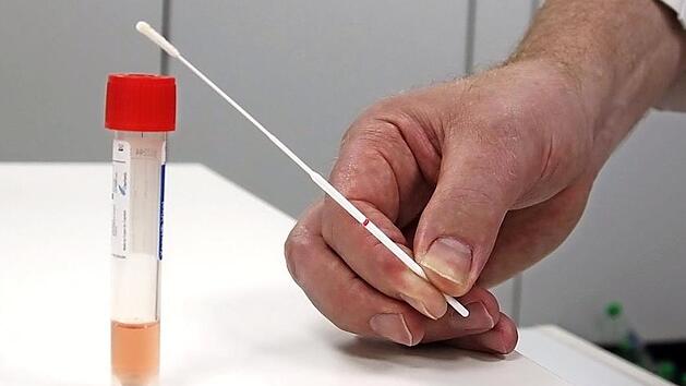 Im Kreiskrankenhaus H&ouml;chstadt gibt es gen&uuml;gend sogenannte PCR-Tests, bislang wollte niemand einen haben. Foto: Andreas Scheuerer