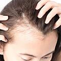 Erlanger Forscher entwickeln Wirkstoff gegen Haarausfall