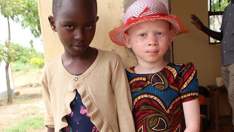 Zwei der Patenkinder: Silvia und Nagma. Nagma ist ein Albino-Mädchen.