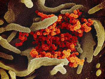 Coronavirus, Mikroskop