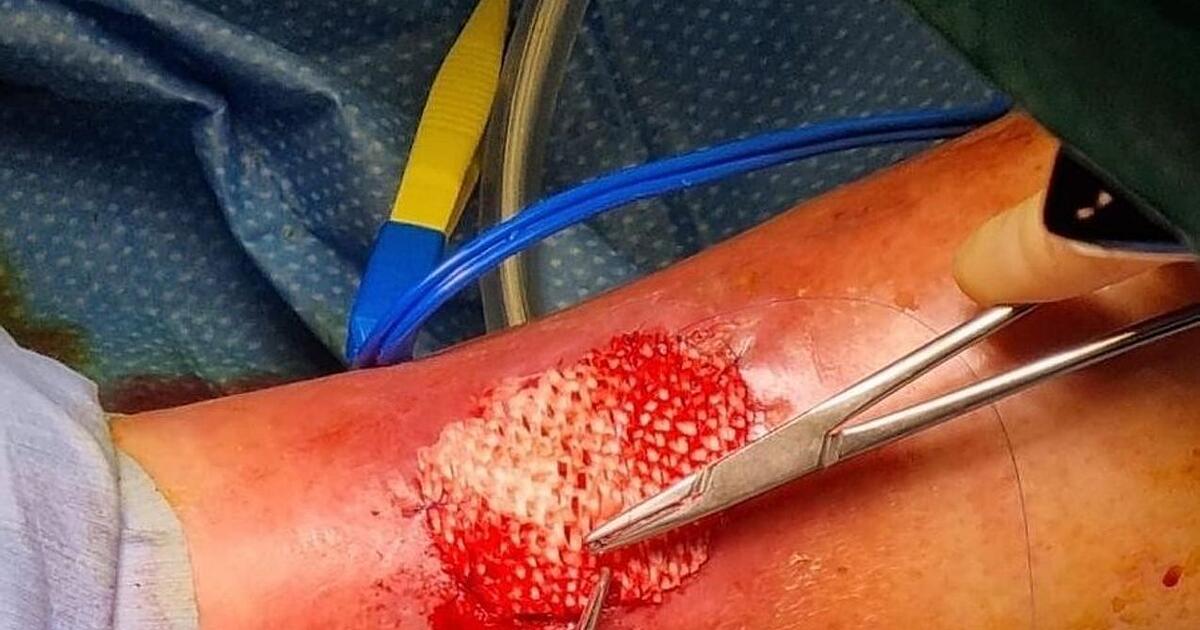 Crans-Montana-Warum-berlebende-ersten-Prognosen-trotzen