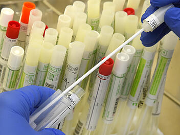 Diagnostik von SARS-CoV-2 und Virusvarianten