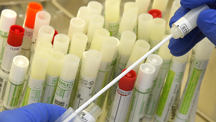 Diagnostik von SARS-CoV-2 und Virusvarianten