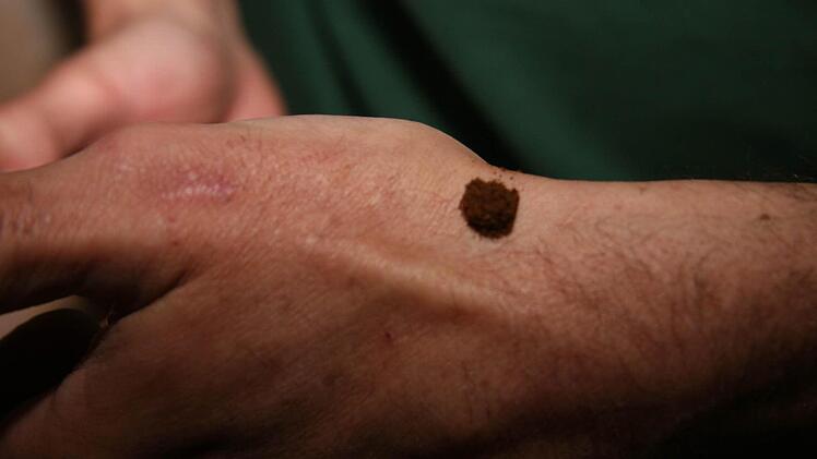 Die Prise passt in die Vertiefung auf dem Handrücken.