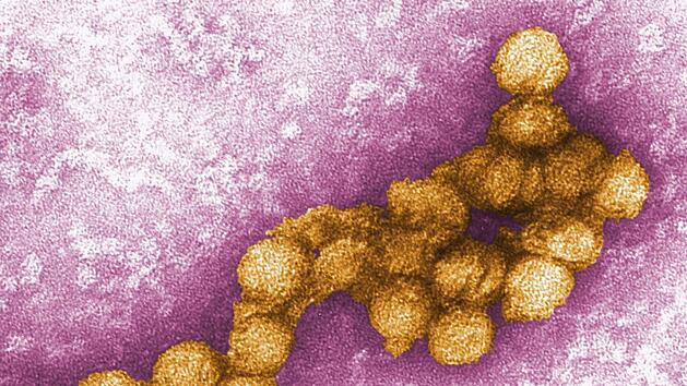 West-Nil-Virus