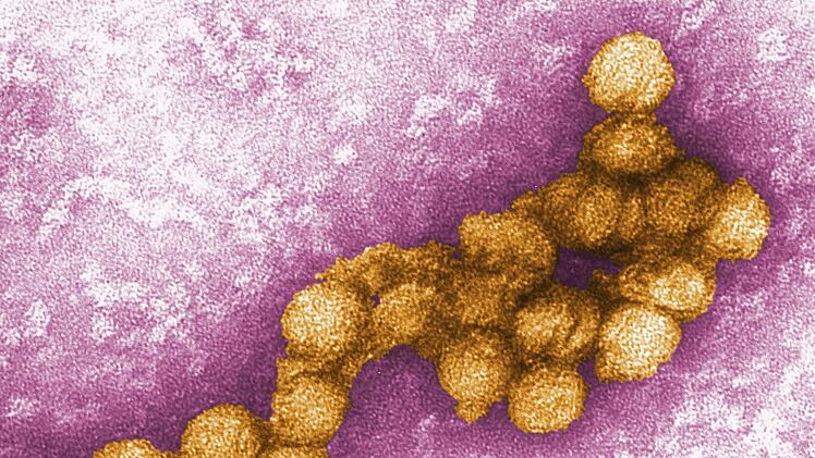West-Nil-Virus