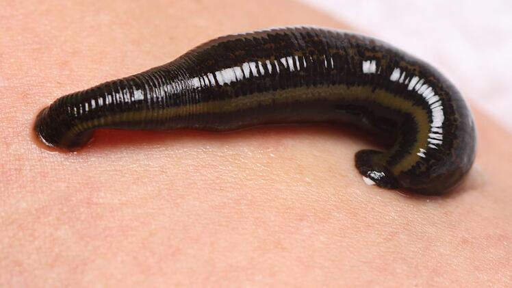 Zwei saugen schon, der dritte sitzt noch im Glas (links). Sie sollen Blut aus dem Knie saugen.  Foto: Susanne Will