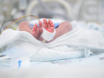 W&uuml;rzburg: Erste Studienergebnisse - So k&ouml;nnen Fr&uuml;hgeborene von Probiotika profitieren