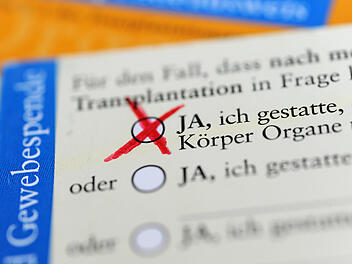 Organspenderecht könnte reformiert werden - das soll sich ändern