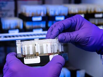 Forscher der Uni Würzburg mit Durchbruch in der Corona-Forschung