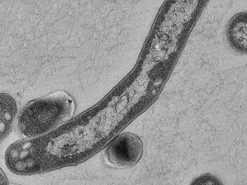 Im Landkreis Forchheim werden pro Jahr im Schnitt fünf Tuberkulosefälle diagnostiziert. Foto: Robert-Koch-Institut/Gudrun Holland, dpa