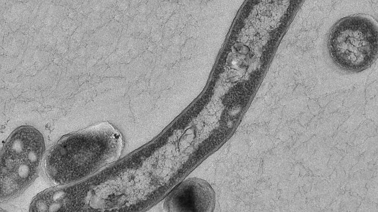 Im Landkreis Forchheim werden pro Jahr im Schnitt fünf Tuberkulosefälle diagnostiziert. Foto: Robert-Koch-Institut/Gudrun Holland, dpa