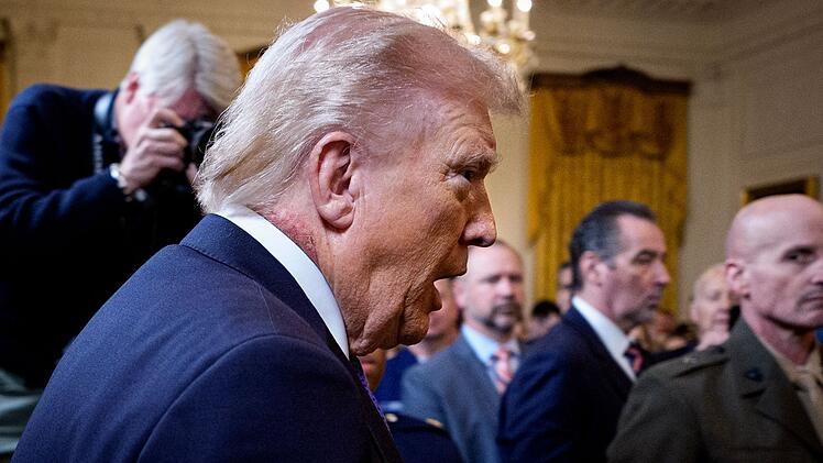 Die R&ouml;tung am Hals von US-Pr&auml;sident Donald Trump sorgt derzeit f&uuml;r wilde Spekulationen.