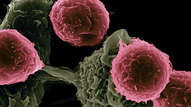 Krebs zählt in Deutschland zur zweithäufigsten Todesursache.