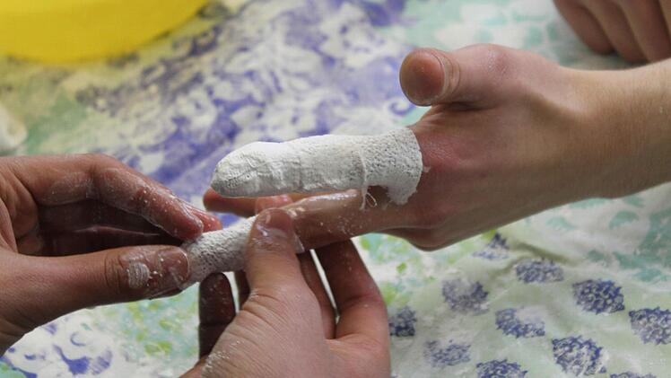 Ein Finger gipst den anderen. Am Samstagnachmittag schliefen dabei so manche Finger in ihrer Ummantelung ein.