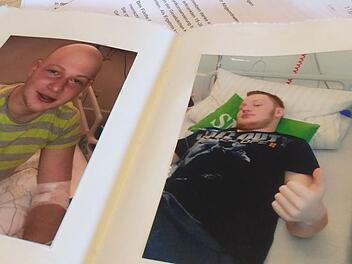 Benedikt Fehd hat seine Haare bei der Chemotherapie verloren. Langsam wachsen sie wieder und es geht aufwärts. Foto: Christiane Lehmann