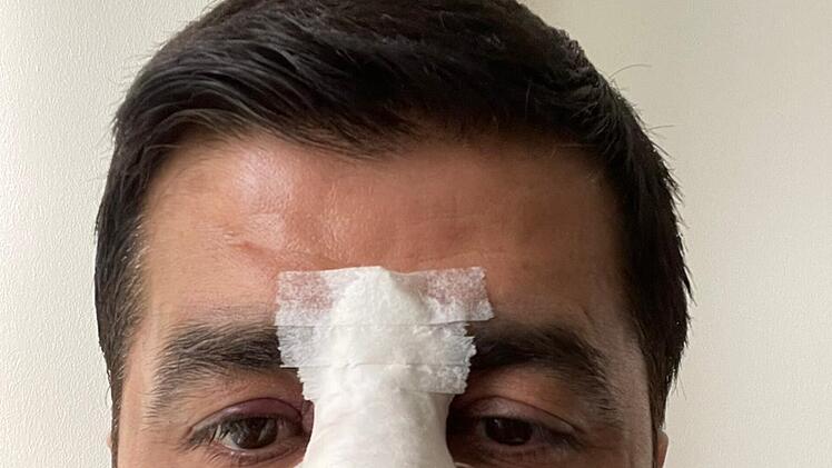 Bayreuth: Nach brutalem rassistischem Angriff - Halil Tasdelen (SPD) will sich nicht verstecken