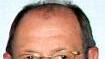 Franz Hubert