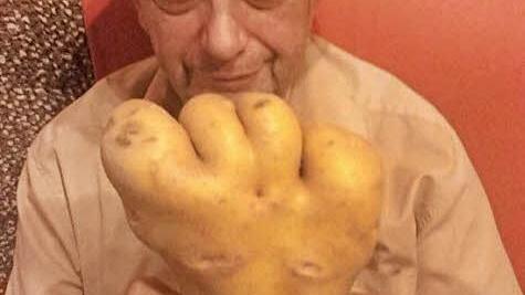 Franz Leicht mit seiner "Fuß-Kartoffel" Foto: p