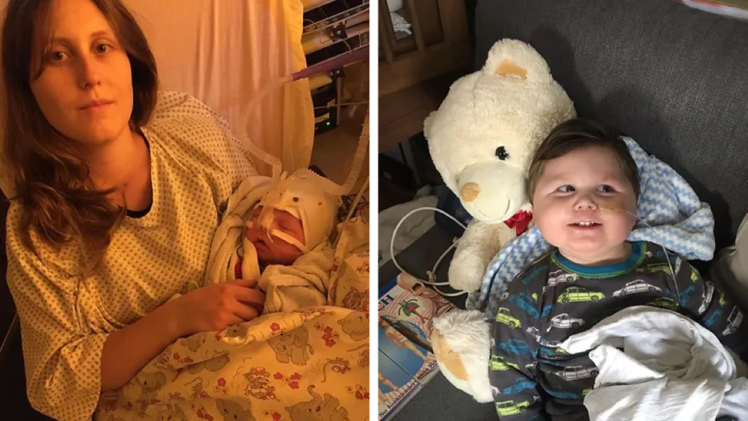 Untersiemau: Nach dramatischer Geburt braucht Elias Pflege rund um die Uhr - Eltern suchen Hilfe