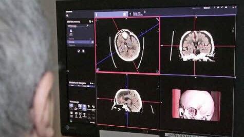 Die Aufnahmen mit dem neuen Computer-Tomographen sind schärfer.
