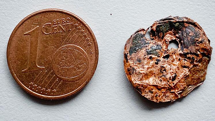 Ärzte entfernen verschluckte und vergessene Münze aus Lunge