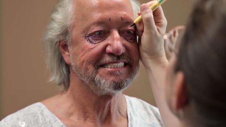 Robert Geiss legt sich mit 62 Jahren erstmals unters Messer.