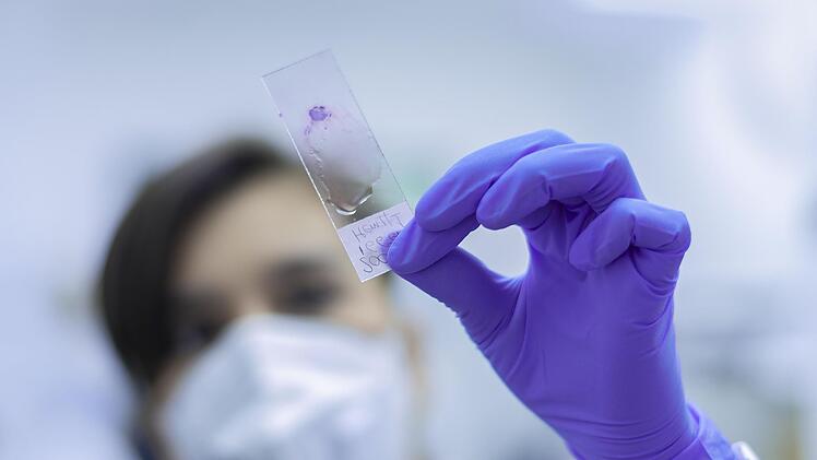 FAU-Forschungsteam gelingt "entscheidender Durchbruch" bei Autoimmunerkrankungen