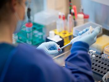 Durchbruch in der Krebsforschung? Erste Impfungen von Biontech schon 2023 Durchbruch in der Krebsforschung? Erste Impfungen von Biontech schon 2023