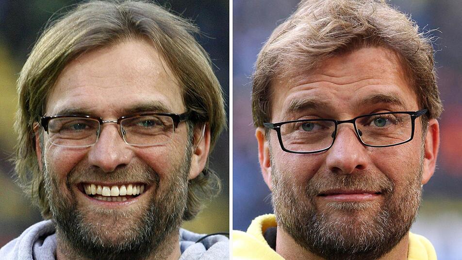 Vorher-Nachher: Der Trainer von Borussia Dortmund, Jürgen Klopp, hat sich Haare einpflanzen lassen. Die Kombo zeigt den Trainer von Borussia Dortmund, Jürgen Klopp - am 11.4.2012 (l) und am 9.3.2013 (r). Foto: Friso Gentsch/Roland Weihrauch/dpa